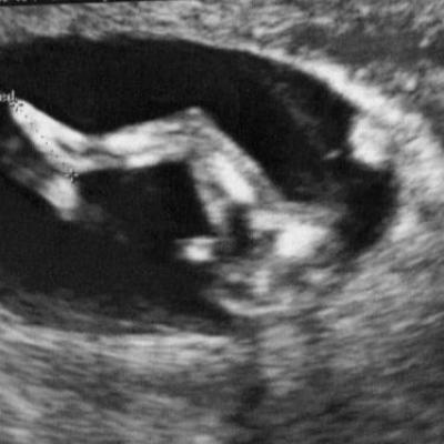 Bébé