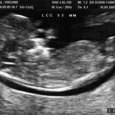 Bébé